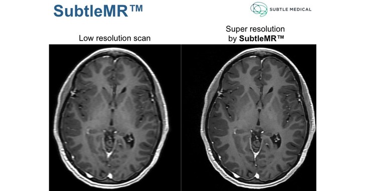Access here alternative investment news about Subtle Medical Raises $12.2M In Series A Funding To Expand Its Ai Imaging Solutions